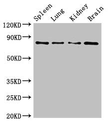 Western Blot | Positive WB detected in: Mouse spleen tissue, Mouse lung tissue, Mouse kidney tissue, Mouse brain tissue | All lanes: PRMT7 antibody at 6.2μg/ml | Secondary | Goat polyclonal to rabbit IgG at 1/50000 dilution | Predicted band size: 79, 63, 74, 64 kDa | Observed band size: 79 kDaRabbit anti-Human PRMT7 Polyclonal Antibody