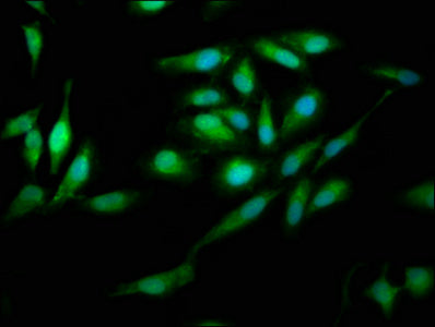 Immunofluorescence staining of Hela cells with PNPO Antibody at 1:200, counter-stained with DAPI. The cells were fixed in 4% formaldehyde, permeabilized using 0.2% Triton X-100 and blocked in 10% normal Goat Serum. The cells were then incubated with the antibody overnight at 4°C. The secondary antibody was Alexa Fluor 488-congugated AffiniPure Goat Anti-Rabbit IgG(H+L).Rabbit anti-Human PNPO Polyclonal Antibody