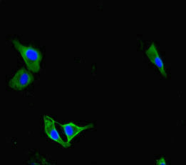 Immunofluorescent analysis of Hela cells using PAG1 Antibody at dilution of 1:100 and Alexa Fluor 488-congugated AffiniPure Goat Anti-Rabbit IgG(H+L)Rabbit anti-Human PAG1 Polyclonal Antibody