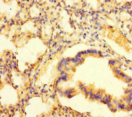 Immunohistochemistry of paraffin-embedded human lung tissue using PAG1 Antibody at dilution of 1:100Rabbit anti-Human PAG1 Polyclonal Antibody