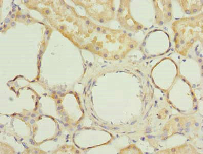Immunohistochemistry of paraffin-embedded human kidney tissue using FAM118A Antibody at dilution of 1:100Rabbit anti-Human FAM118A Polyclonal Antibody