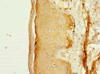 Immunohistochemistry of paraffin-embedded human skin tissue using FAM118A Antibody at dilution of 1:100Rabbit anti-Human FAM118A Polyclonal Antibody