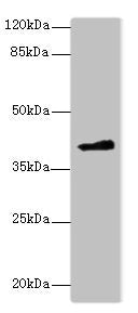 Western blot  | All lanes: FAM118A antibody at 4µg/ml + 293T whole cell lysate  | Secondary  | Goat polyclonal to rabbit IgG at 1/10000 dilution  | Predicted band size: 41, 20 kDa  | Observed band size: 41 kDaRabbit anti-Human FAM118A Polyclonal Antibody