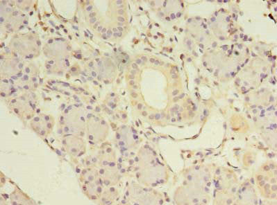 Immunohistochemistry of paraffin-embedded human pancreatic tissue using NKIRAS1 Antibody at dilution of 1:100Rabbit anti-Human NKIRAS1 Polyclonal Antibody