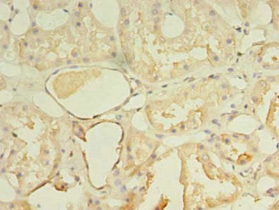 Immunohistochemistry of paraffin-embedded human kidney tissue using NKIRAS1 Antibody at dilution of 1:100Rabbit anti-Human NKIRAS1 Polyclonal Antibody