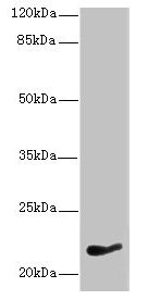 Western blot  | All lanes: NKIRAS1 antibody at 7µg/ml + HepG2 whole cell lysate  | Secondary  | Goat polyclonal to rabbit IgG at 1/10000 dilution  | Predicted band size: 22 kDa  | Observed band size: 22 kDaRabbit anti-Human NKIRAS1 Polyclonal Antibody