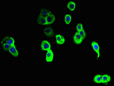Immunofluorescent analysis of A431 cells using NINJ2 Antibody at dilution of 1:100 and Alexa Fluor 488-congugated AffiniPure Goat Anti-Rabbit IgG(H+L)Rabbit anti-Human NINJ2 Polyclonal Antibody
