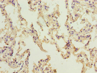 Immunohistochemistry of paraffin-embedded human lung tissue using the antibody at dilution of 1:100Rabbit anti-Human NINJ2 Polyclonal Antibody