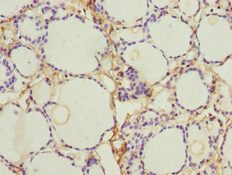 Immunohistochemistry of paraffin-embedded human thyroid tissue using NINJ2 Antibody at dilution of 1:100Rabbit anti-Human NINJ2 Polyclonal Antibody