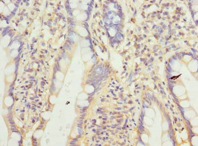 Immunohistochemistry of paraffin-embedded human small intestine tissue using CNIH4 Antibody at dilution of 1:100Rabbit anti-Human CNIH4 Polyclonal Antibody