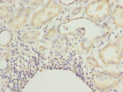Immunohistochemistry of paraffin-embedded human kidney tissue using CNIH4 Antibody at dilution of 1:100Rabbit anti-Human CNIH4 Polyclonal Antibody
