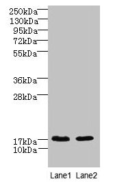 Western blot  | All lanes: CNIH4 antibody at 0.3µg/ml  | Lane 1: A431 whole cell lysate  | Lane 2: U251 whole cell lysate  | Secondary  | Goat polyclonal to rabbit IgG at 1/10000 dilution  | Predicted band size: 17, 11 kDa  | Observed band size: 17 kDaRabbit anti-Human CNIH4 Polyclonal Antibody