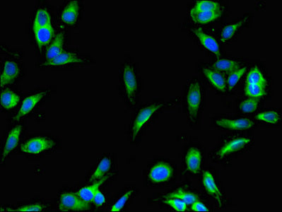 Immunofluorescent analysis of Hela cells using SENP1 Antibody at dilution of 1:100 and Alexa Fluor 488-congugated AffiniPure Goat Anti-Rabbit IgG(H+L)Rabbit anti-Human SENP1 Polyclonal Antibody