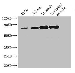 Western BlotPositive WB detected in: Hela whole cell lysate, HL60 whole cell lysate, Mouse spleen tissue, Mouse stomach tissue, Mouse skeletal muscle tissueAll lanes: SENP1 antibody at 2.7μg/mlSecondaryGoat polyclonal to rabbit IgG at 1/50000 dilutionPredicted band size: 74 kDaObserved band size: 74 kDaRabbit anti-Human SENP1 Polyclonal Antibody
