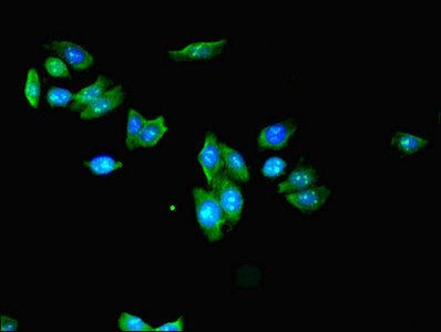 Immunofluorescent analysis of HepG2 cells using KLHL42 Antibody at dilution of 1:100 and Alexa Fluor 488-congugated AffiniPure Goat Anti-Rabbit IgG(H+L)