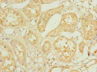 Immunohistochemistry of paraffin-embedded human kidney tissue using the antibody at dilution of 1:100