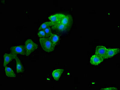 Immunofluorescent analysis of HepG2 cells using STARD9 Antibody at a dilution of 1:100 and Alexa Fluor 488-congugated AffiniPure Goat Anti-Rabbit IgG(H+L)Rabbit anti-Human STARD9 Polyclonal Antibody