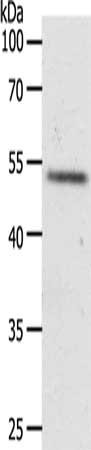 Gel: 10%SDS-PAGE, Lysate: 40 μg, Lane: Jurkat cells, Primary antibody: RXFP3 Antibody(RXFP3 Antibody) at dilution 1/350, Secondary antibody: Goat anti rabbit IgG at 1/8000 dilution, Exposure time: 10 minutesRabbit anti-Human RXFP3 Polyclonal Antibody
