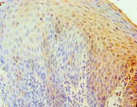 Immunohistochemistry of paraffin-embedded human tonsil tissue using TNFRSF10D Antibody at dilution of 1:100