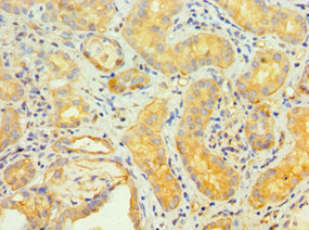 Immunohistochemistry of paraffin-embedded human kidney tissue using TNFRSF10D Antibody at dilution of 1:100