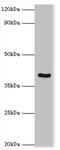 Western blot | All lanes: Tumor necrosis factor receptor superfamily member 10D antibody at 2μg/ml + Mouse liver tissue | Secondary | Goat polyclonal to rabbit IgG at 1/10000 dilution | Predicted band size: 42 kDa | Observed band size: 42 kDa