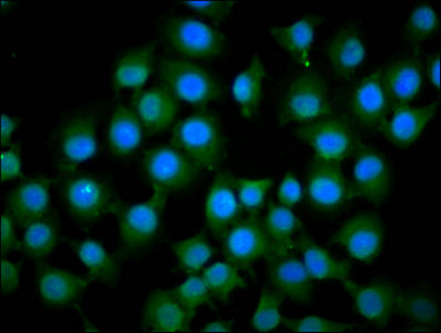 Immunofluorescence staining of A549 cells with IFT172 Antibody at 1:133, counter-stained with DAPI. The cells were fixed in 4% formaldehyde, permeabilized using 0.2% Triton X-100 and blocked in 10% normal Goat Serum. The cells were then incubated with the antibody overnight at 4°C. The secondary antibody was Alexa Fluor 488-congugated AffiniPure Goat Anti-Rabbit IgG(H+L).Rabbit anti-Human IFT172 Polyclonal Antibody