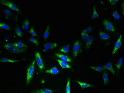 Immunofluorescent analysis of Hela cells using NAT8 Antibody at dilution of 1:100 and Alexa Fluor 488-congugated AffiniPure Goat Anti-Rabbit IgG(H+L)Rabbit anti-Human NAT8 Polyclonal Antibody