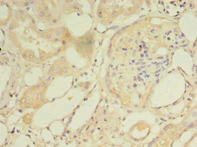 Immunohistochemistry of paraffin-embedded human kidney tissue using NAT8 Antibody at dilution of 1:100Rabbit anti-Human NAT8 Polyclonal Antibody