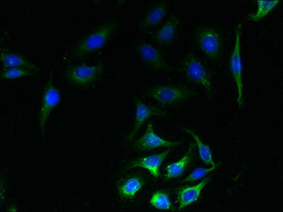 Immunofluorescent analysis of A549 cells using SLC23A1 Antibody at dilution of 1:100 and Alexa Fluor 488-congugated AffiniPure Goat Anti-Rabbit IgG(H+L)Rabbit anti-Human SLC23A1 Polyclonal Antibody