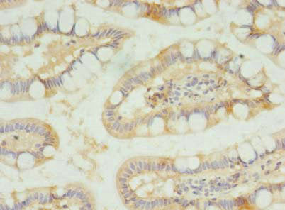 Immunohistochemistry of paraffin-embedded human small intestine tissue using SLC23A1 Antibody at dilution of 1:100Rabbit anti-Human SLC23A1 Polyclonal Antibody