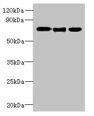 Western blotAll lanes: SLC23A1 antibody at 3μg/mlLane 1: A549 whole cell lysateLane 2: Mouse liver tissueLane 3: Mouse kidney tissueSecondaryGoat polyclonal to rabbit IgG at 1/10000 dilutionPredicted band size: 65, 66, 29 kDaObserved band size: 65 kDaRabbit anti-Human SLC23A1 Polyclonal Antibody