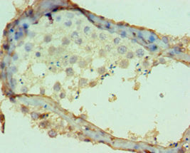 Immunohistochemistry of paraffin-embedded human testis tissue using DPP7 Antibody at dilution of 1:100