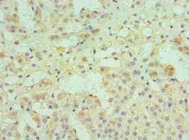Immunohistochemistry of paraffin-embedded human adrenal gland tissue using DPP7 Antibody at dilution of 1:100