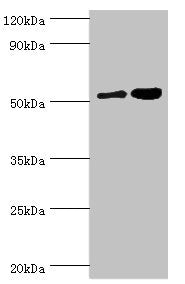 Western blot | All lanes: Dipeptidyl peptidase 2 antibody at 6μg/ml | Lane 1: K562 whole cell lysate | Lane 2: Rat brain tissue | Secondary | Goat polyclonal to rabbit IgG at 1/10000 dilution | Predicted band size: 54 kDa | Observed band size: 54 kDa