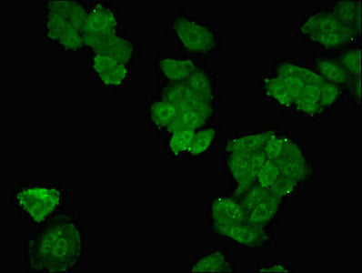 Immunofluorescent analysis of HepG2 cells using SMPX Antibody at dilution of 1:100 and Alexa Fluor 488-congugated AffiniPure Goat Anti-Rabbit IgG(H+L)Rabbit anti-Human SMPX Polyclonal Antibody