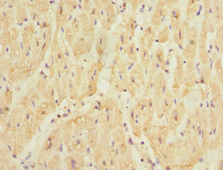 Immunohistochemistry of paraffin-embedded human heart tissue using SMPX Antibody at dilution of 1:100Rabbit anti-Human SMPX Polyclonal Antibody