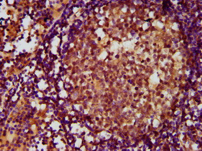 IHC image of the antibody diluted at 1:500 and staining in paraffin-embedded human lymph node tissue performed on a Leica BondTM system. After dewaxing and hydration, antigen retrieval was mediated by high pressure in a citrate buffer (pH 6.0). Section was blocked with 10% normal goat serum 30min at RT. Then primary antibody (1% BSA) was incubated at 4°C overnight. The primary is detected by a biotinylated secondary antibody and visualized using an HRP conjugated SP system.
