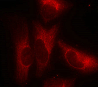 Immunofluorescence staining of methanol-fixed Hela cells using 14-3-3z(Phospho-Ser58) Antibody.Rabbit anti-Human YWHAZ Polyclonal Antibody