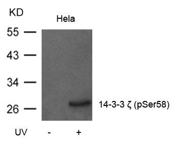 Western blot analysis of extracts from Hela cells untreated or treated with UV using 14-3-3z(Phospho-Ser58) Antibody.Rabbit anti-Human YWHAZ Polyclonal Antibody