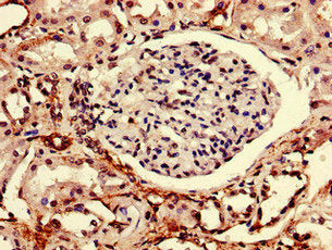 Immunohistochemistry of paraffin-embedded human kidney tissue using RTP3 Antibody at dilution of 1:100Rabbit anti-Human RTP3 Polyclonal Antibody