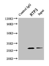 Immunoprecipitating RTP3 in Mouse brain tissue  | Lane 1: Rabbit control IgG (1µg) instead of RTP3 Antibody in Mouse brain tissue. For western blotting, a HRP-conjugated light chain specific antibody was used as the secondary antibody (1/50000)  | Lane 2: RTP3 Antibody (8µg) + Mouse brain tissue (500µg)  | Lane 3: Mouse brain tissue (10µg)Rabbit anti-Human RTP3 Polyclonal Antibody