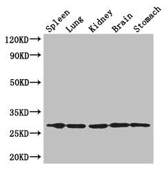 Western Blot  | Positive WB detected in: Mouse spleen tissue, , Mouse lung tissue, Mouse kidney tissue, Mouse brain tissue, Mouse stomach tissue  | All lanes: RTP3 antibody at 3μg/ml  | Secondary  | Goat polyclonal to rabbit IgG at 1/50000 dilution  | Predicted band size: 28 kDa  | Observed band size: 28 kDaRabbit anti-Human RTP3 Polyclonal Antibody