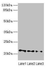 Western blot  | All lanes: VPS25 antibody at 3µg/ml  | Lane 1: Mouse kidney tissue  | Lane 2: HL60 whole cell lysate  | Lane 3: THP-1 whole cell lysate  | Secondary  | Goat polyclonal to rabbit IgG at 1/10000 dilution  | Predicted band size: 21 kDa  | Observed band size: 21 kDaRabbit anti-Human VPS25 Polyclonal Antibody
