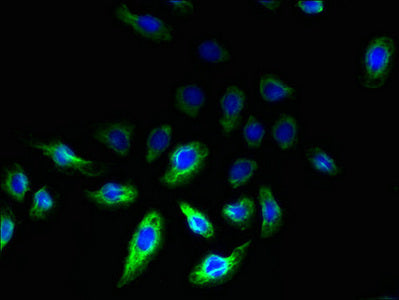 Immunofluorescent analysis of A549 cells using REEP2 Antibody at dilution of 1:100 and Alexa Fluor 488-congugated AffiniPure Goat Anti-Rabbit IgG(H+L)Rabbit anti-Human REEP2 Polyclonal Antibody