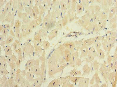 Immunohistochemistry of paraffin-embedded human heart tissue using REEP2 Antibody at dilution of 1:100Rabbit anti-Human REEP2 Polyclonal Antibody