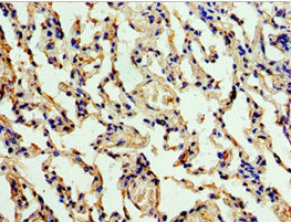 Immunohistochemistry of paraffin-embedded human lung tissue using ALG1 Antibody at dilution of 1:100Rabbit anti-Human ALG1 Polyclonal Antibody