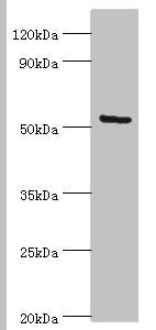 Western blot | All lanes: ALG1 antibody at 10μg/ml + Hela whole cell lysate | Secondary | Goat polyclonal to rabbit IgG at 1/10000 dilution | Predicted band size: 53, 41 kDa | Observed band size: 53 kDaRabbit anti-Human ALG1 Polyclonal Antibody