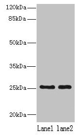 Western blot  | All lanes: NDFIP1 antibody at 8µg/ml  | Lane 1: 293T whole cell lysate  | Lane 2: Hela whole cell lysate  | Secondary  | Goat polyclonal to rabbit IgG at 1/10000 dilution  | Predicted band size: 25, 17 kDa  | Observed band size: 25 kDaRabbit anti-Human NDFIP1 Polyclonal Antibody
