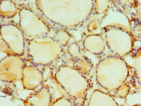 Immunohistochemistry of paraffin-embedded human thyroid tissue using DIDO1 Antibody at dilution of 1:100Rabbit anti-Human DIDO1 Polyclonal Antibody