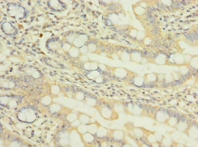 Immunohistochemistry of paraffin-embedded human small intestine tissue using NUP58 Antibody at dilution of 1:100Rabbit anti-Human NUP58 Polyclonal Antibody